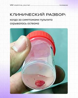 «Диагностический поиск: клинический случай Алисы Волошиной».